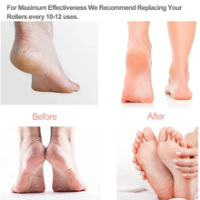 Load image into Gallery viewer, Rechargeable Electronic Foot File Pedicure Kit

